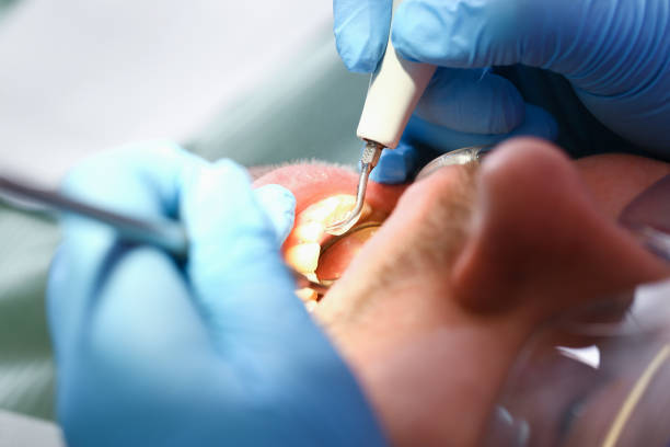 Best Pediatric Emergency Dentist in Niwot, CO